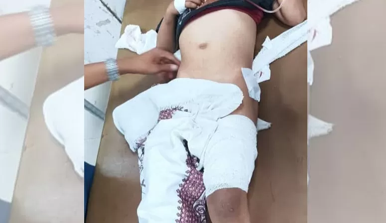 إصابة طفل برصاص قناص يعتقد أنه تابع لجماعة الحوثيين في تعز